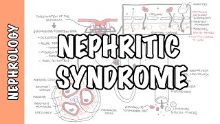 Nephritic Syndrome  classification pathophysiology treatment RPGN ANCA Immune complex [upl. by Bellamy]