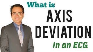 Axis Deviation in ECG Made Easy Causes How to determine Axis in ECG Explained ECG Lecture USMLE [upl. by Eriha193]