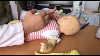 Neonatal examination part4 by DrHaider [upl. by Easton]