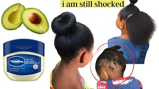 How I Used AVOCADO and VASELINE For Extreme Hair Growth and Thickness [upl. by Sonny]