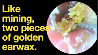 Like mining two pieces of golden earwaxear wax removal  ear cleaning  ASMR  relaxation  relax [upl. by Yahsram]