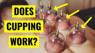 Does Cupping Therapy ACTUALLY Work [upl. by Eugenie181]