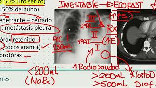 Hemotorax Neumotorax Torqx Inestable [upl. by Nnylatsyrk]