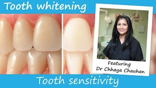 Tooth sensitivity when whitening [upl. by Jonathon]