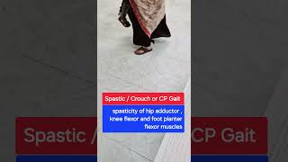 Spastic gait  gait in cerebral palsy  Crouch gait  Gait examination gait neurology [upl. by Yrmac569]