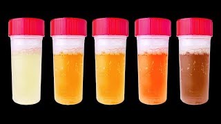 7 Choses Que Ton Urine Peut Révéler Sur ta Santé [upl. by Tiffanie550]