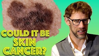 How To Check For Melanoma In 5 Easy Steps  Skin Cancer Assessment  Dr Gill [upl. by Arevle]