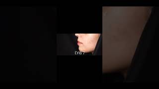 Skintelligent  14 Days Acne Free Face  Davis And Co Aesthetics asmr rejuvenatedskin skincare [upl. by Sperry871]