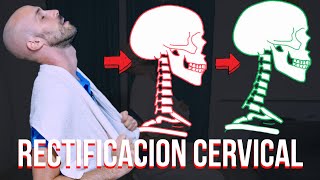 El MEJOR ejercicio para la RECTIFICACION CERVICAL [upl. by Ecart]