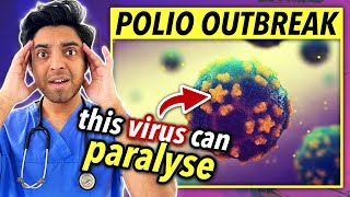 Polio Outbreak Hits UK amp US  DOCTOR Explains What You Need to Know [upl. by Enomahs]