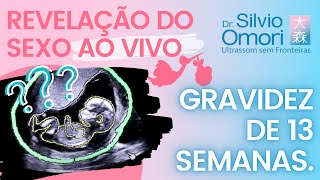 ULTRASSOM OBSTÉTRICA Gravidez 13 semanas Revelação se menino ou menina AO VIVO [upl. by Earissed]