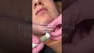 How to Get Rid of Double Chin Fat without Surgery [upl. by Collbaith]