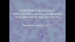 Peripheral blood film evaluation a critical component of a complete blood count CBC [upl. by Kristen]