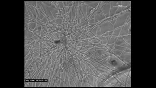 Ralstonia solanacearum lipopeptide induces chlamydospore development in fungi and facilitates [upl. by Aihtenak]