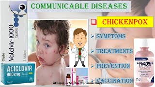 MEDICINAL TREATMENTS OF CHICKENPOX SYMPTOMS  PREVENTION AND VACCINATION [upl. by Naiva]