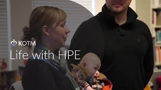 KOTM Parent Stories Holoprosencephaly HPE [upl. by Venable699]