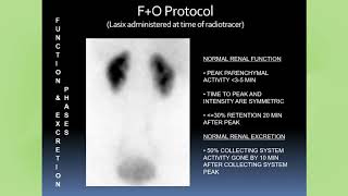 Diuretic Renal Scintigraphy in 2020 Where We Are February 2020 [upl. by Welcy]