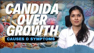 Candida Overgrowth Causes Risk Factors and How to Keep It in Check  Dt Vineesha Reddy [upl. by Alexine]