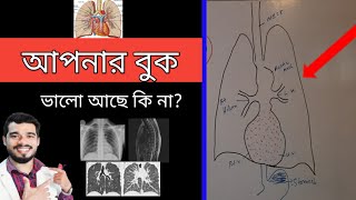 বুকের পরীক্ষা  বুকের রোগ  CXR PA VIEW  Chest medical Investigations  Chest xray  xray [upl. by Omlesna]