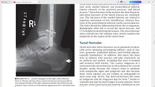 RADIOLOGY EXAM CASES [upl. by Eisiam]