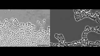 Pseudomonas aeruginosa biofilm expansion via twitching motility [upl. by Yenttirb]