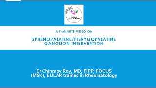 5Minute Video sphenopalatine ganglion block [upl. by Dyun278]