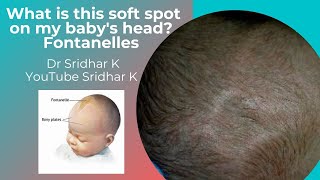 What is this soft spot on the top of my babys head Anterior fontanelle Dr Sridhar Kalyanasundaram [upl. by Inattyrb]