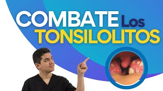 Combate LOS TONSILOLITOS🔥🦷  Tips para ELIMINARLOS que no te dicen los doctores 💥 [upl. by Daigle]