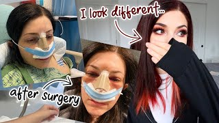 I had to get reconstructive surgery on my face  Kelli Marissa Vlogs [upl. by Lorilyn]