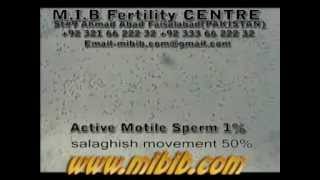 active motile sperm 1 sluggish motile 50 videolow sperm count video [upl. by Elad]