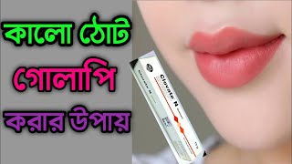 ঠোটের কালো দাগ দূর করার উপায় Tother kalo dag dur korar upay জেনে নিন কালো ঠোট গোলাপি করার ক্রিম [upl. by Rao]