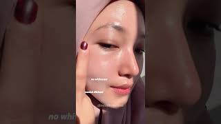 theraskinkosmetika theraskinsunscreen theraskinbpomamanhalal theraskinreview therapyforyourskin [upl. by Algie]