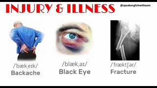 INJURY amp ILLNESS 🩹 in English  VOCABULARY with Pronunciation and pictures [upl. by Sherris]