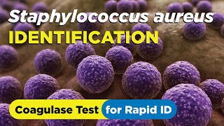 How to identify Staphylococcus aureus using the Coagulase Test  Slide and Tube Method [upl. by Annoj]