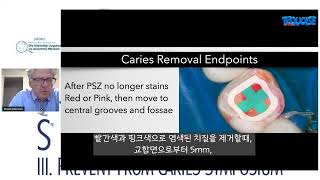 The Six Lessons Approach to Biomimetic Restorative Dentistry한글자막 [upl. by Warram]