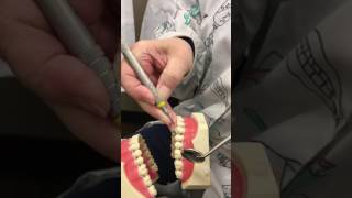 Instrumentation on Maxilla Universal Curettes part 2 [upl. by Neeleuqcaj]