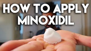 How to Apply Minoxidil Solution for Maximum Result [upl. by Annavoig]