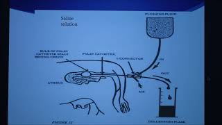 Bovine Embryo Transfer Facts2 Conventional Flush Method [upl. by Duky615]