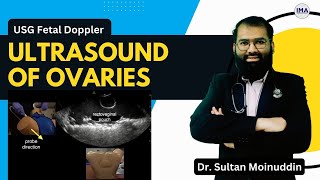 Ultrasound of OVARIES  Practical Scanning Technique by Dr Sultan Moinuddin  Iqramed Academy [upl. by Ecnesse714]