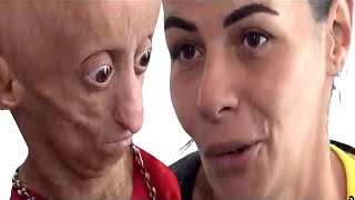 Reportage special RANIA Complet Interview avec sa Mere Maladie Progeria Nanisme Didek74 [upl. by Ardnoet192]