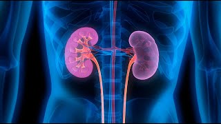 kidney transplantation and hypertensive nephrosclerosis [upl. by Ainafets]