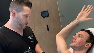 Man Gets Botox for Excessive Sweating  Under the Armpits  West Hollywood CA  Dr Jason Emer [upl. by Nodmac85]