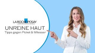 Unreine Haut Tipps gegen Pickel und Mitesser  La Roche Posay [upl. by Yvel]