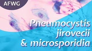 Latest on P jirovecii microsporidia – Prof D Marriott [upl. by Kcor]