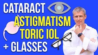 Cataract astigmatism toric IOL glasses and IOL selection [upl. by Sirtaeb]