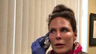 PRP for facial rejuvenation by Linda Owsley RN [upl. by Ramed]