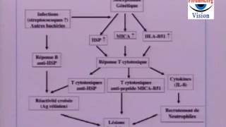 Les Symptômes de la Maladie de Behçet [upl. by Annodal]