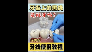 牙齿黑线是蛀牙吗？该如何正确使用牙线 保姆级牙线使用教程 非常简单入手 [upl. by Bridie]