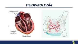 Fibrilación auricular Diagnóstico y tratamiento [upl. by Arretal180]