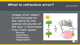 Refractive Error  A Patient Guide to Glasses [upl. by Idnarb561]